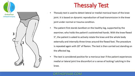 Jun 8, 2019 · The Thessaly test is a dynamic clinical test. The examiner supports the patient by holding their outstretched hands as the patient stands flatfooted on the floor 1: the patient then stands on single leg in full weight bearing on the side to be tested. the non-test leg is flexed at the knee to remove all weight bearing surfaces. 